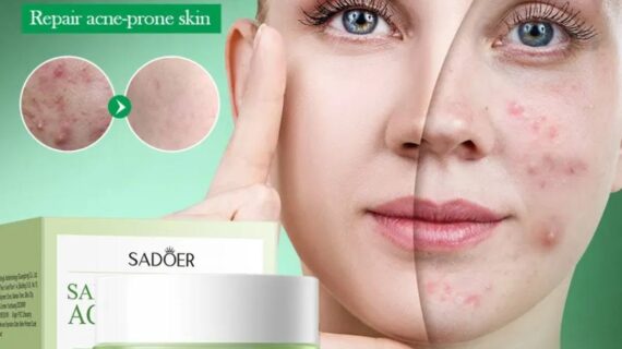 SADOER 3% Salicylic Acid Acne Repair Cream