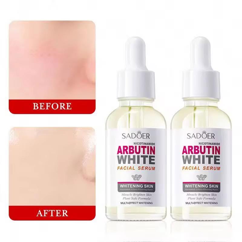 Arbutin White Facial Serum - Image 7