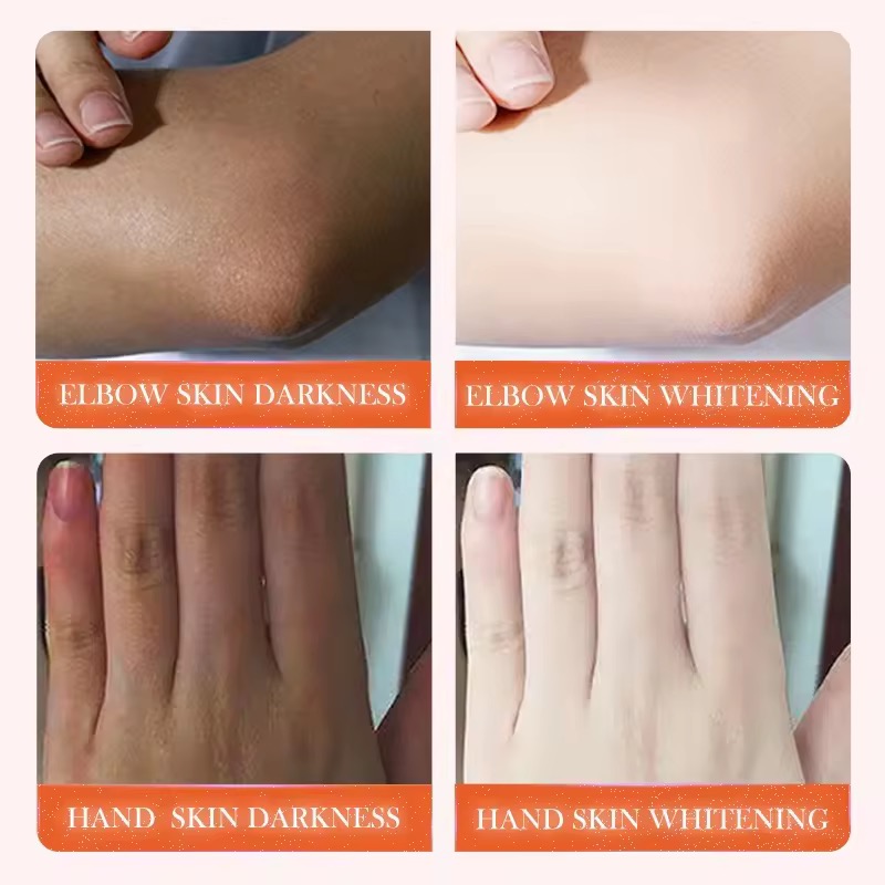 SADOER Dark Knuckle Whitening Serum - Image 2