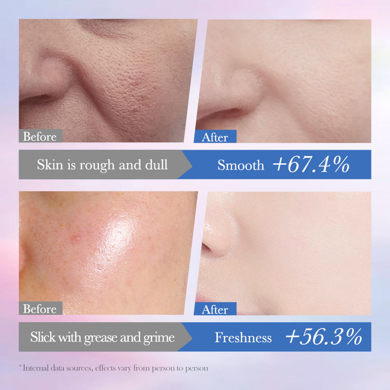 Niacinamide 10% Brightening Spot Removal Facial Cleanser - Image 3