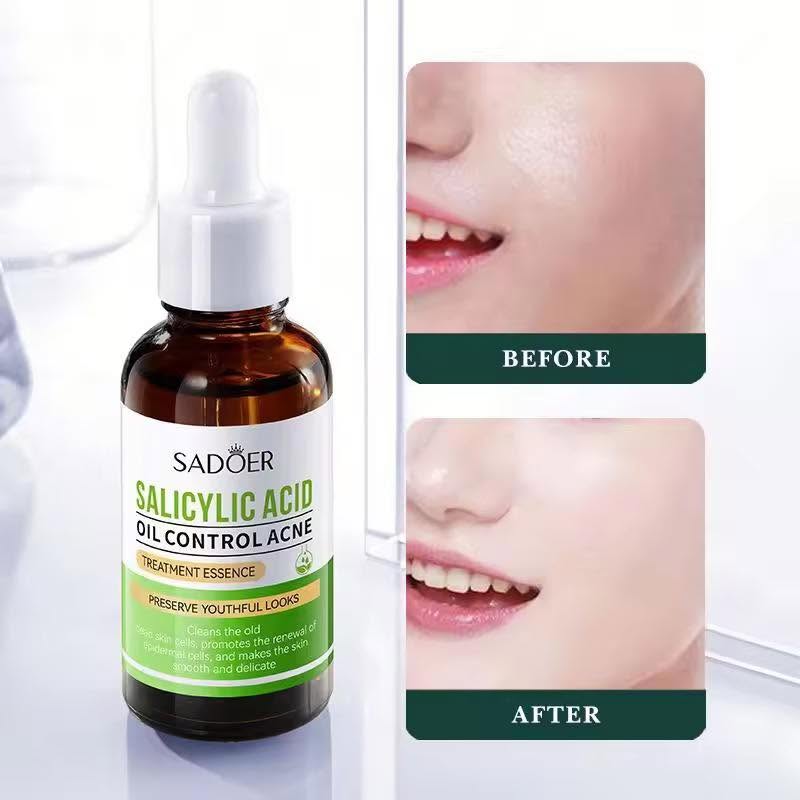 Salicylic Acid Serum - Image 2